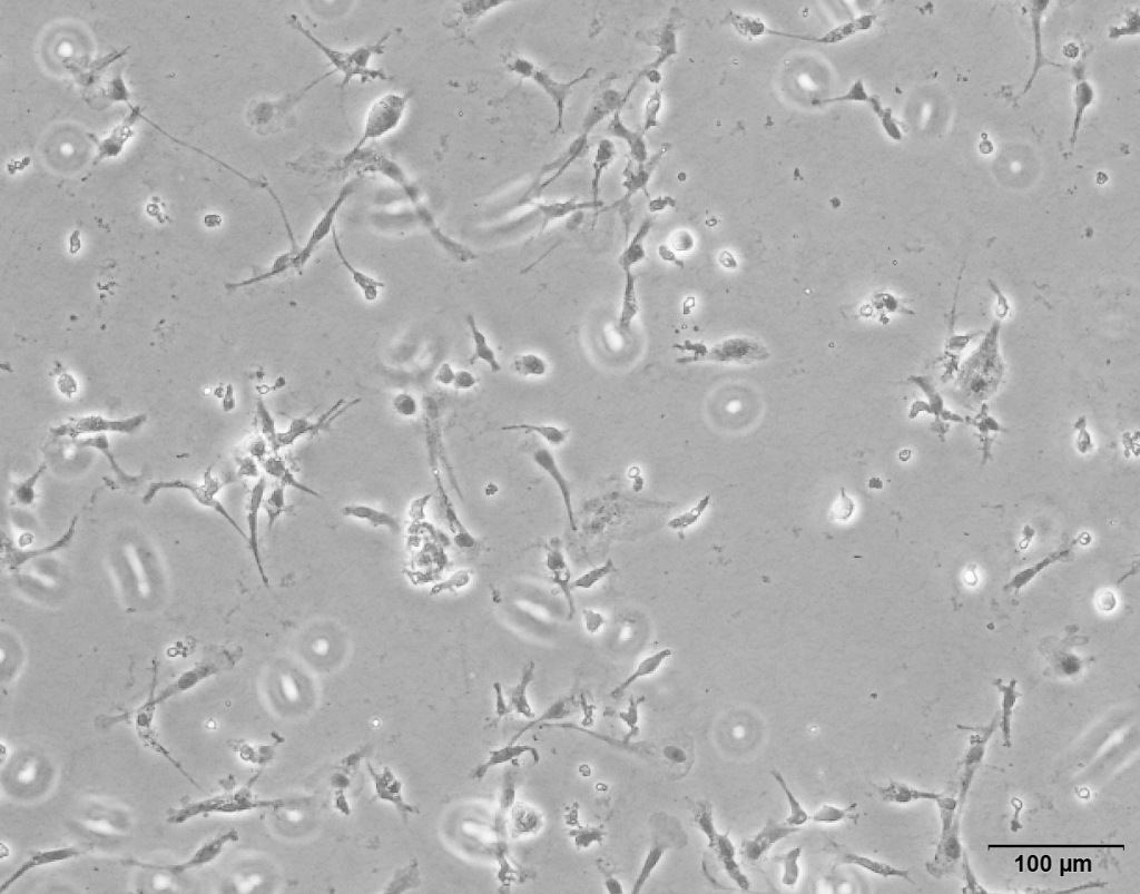 追问｜科学家如何发现或能治疗自闭症的新药物分子？